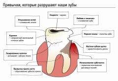 Привычки разрушающие зубыКак вредные привычки разрушают наши зубы? Рассказывает врач-стоматолог НГСП стоматология здоровье зубов 