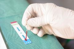 ТестированиеОколо ТЦ "Мадагаскар" будут тестировать на ВИЧ СПИД 