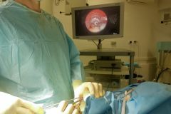 ОперацияВ 2023 году врачи нейрохирургического отделения РКБ провели 803 операции, из них 333 – высокотехнологичные вмешательства здравоохранение 