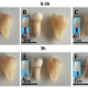 Китайцы предложили абсолютно новый способ быстрого отбеливания зубов наука стоматология 